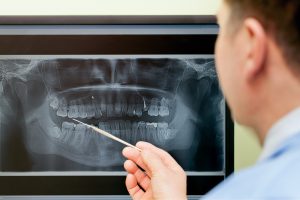 beaches-dentist-xray state of the art equipment
